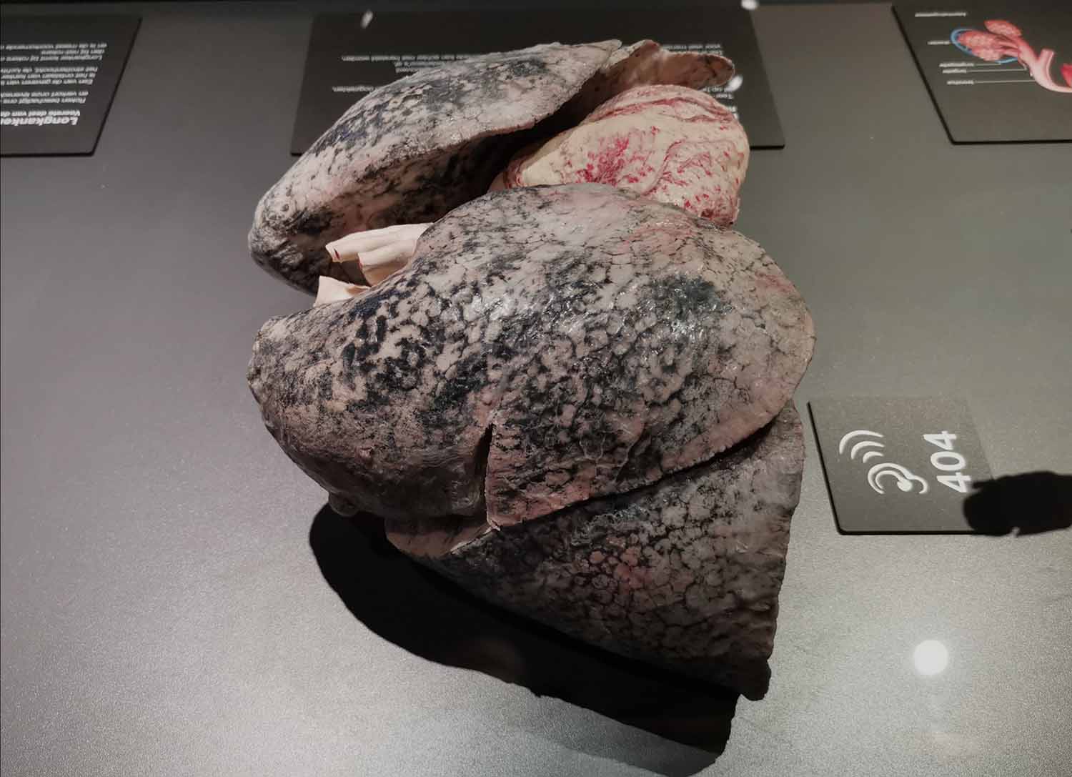 Smokers lungs / Rokerslongen